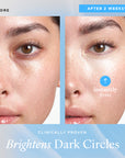 Before and after images showing improvement in dark circles and firmness around the eyes after 2 weeks.